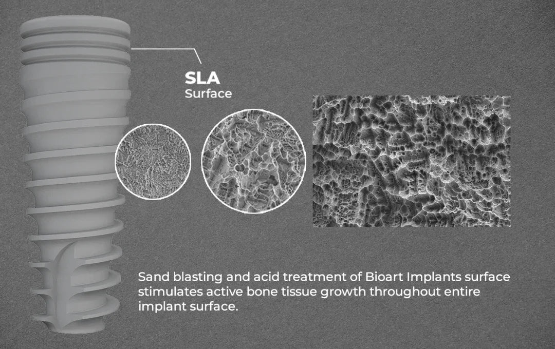 The Ultimate Guide to SLA Surface Implant – Spiral Implant